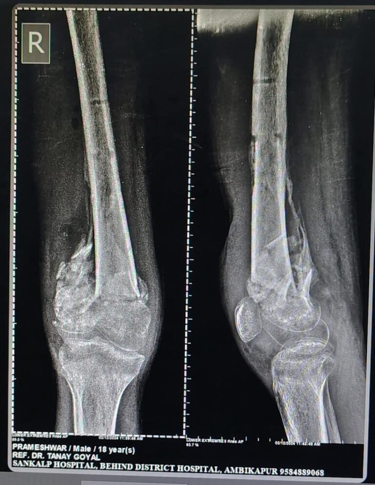 PRE OPERATIVE